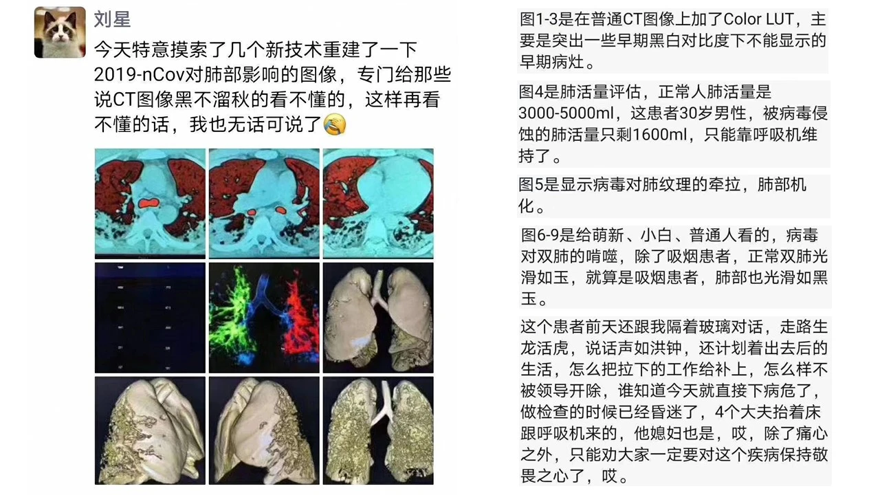中小企业疫情应对